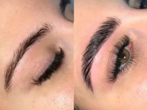 10 Tratamientos que debes ofrecer en tu estética