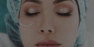 Electroporación facial: una técnica sencilla con resultados increíbles