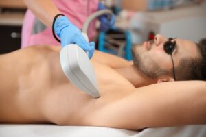 Depilación masculina: un servicio en boga