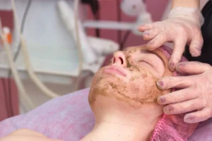Peeling químico: tipos, beneficios y cuidados