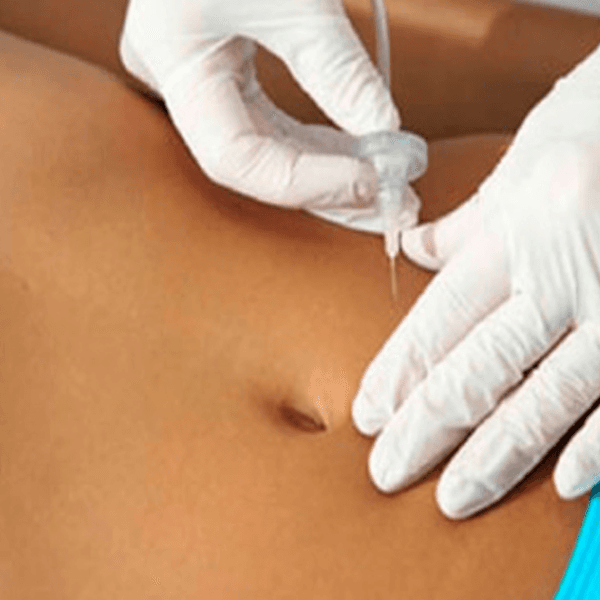 PAQ. CARBOX + LIOPOLASER