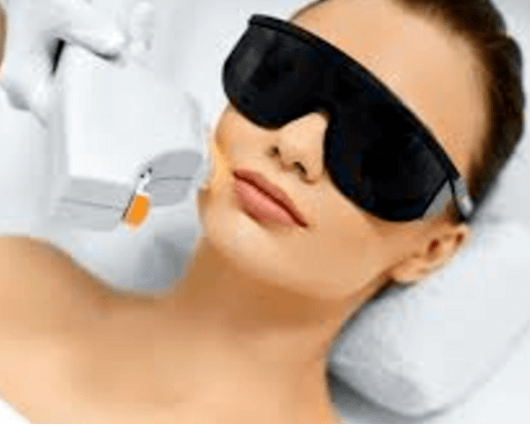 IPL Luz pulzada intensa 