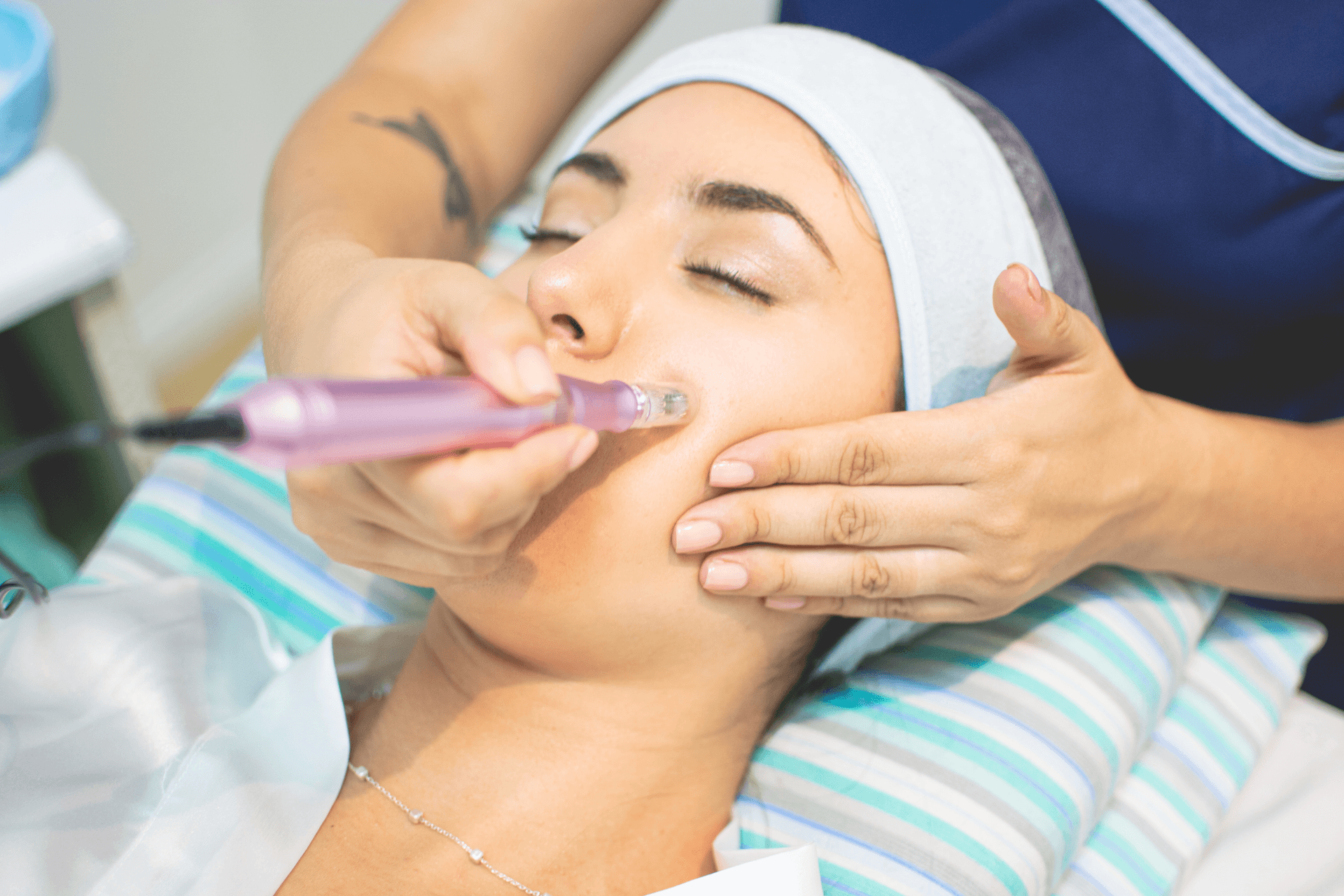 Higiene Facial c/ Dermapen con ampollas - 1 sesion