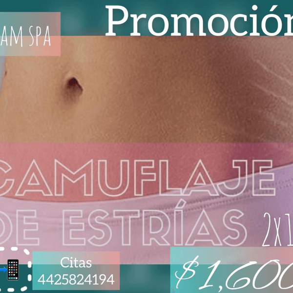 CAMUFLAJE DE ESTRIAS  1 SESION