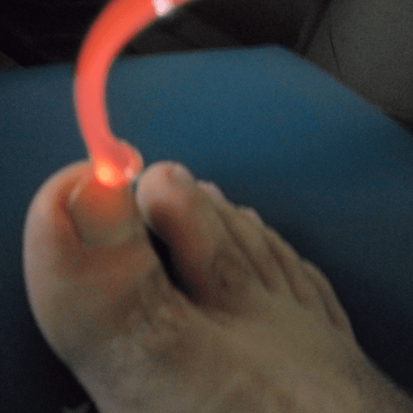 PODOLOGIA + TRATAMIENTO HONGOS