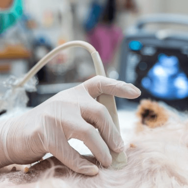 Ecografía Abdominal