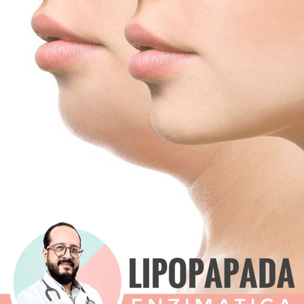 LIPOPAPADA ENZIMATICA