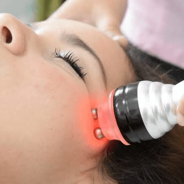 Radiofrecuencia Facial 
