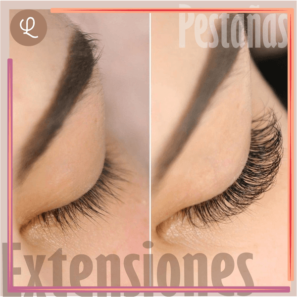 Retoque Ext Clasica 16 a 20 Días 