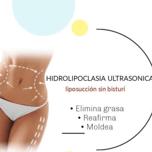 HIDROLIPOCLASIA ULTRASONICA