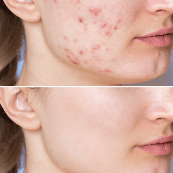 Peeling organico Zena Facial (realizado por Kat)