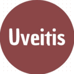 Uveitis photo