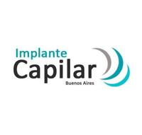 IMPLANTE CAPILAR BUENOS AIRES