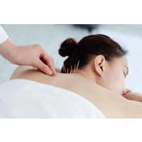 Huoli Acupuntura logo