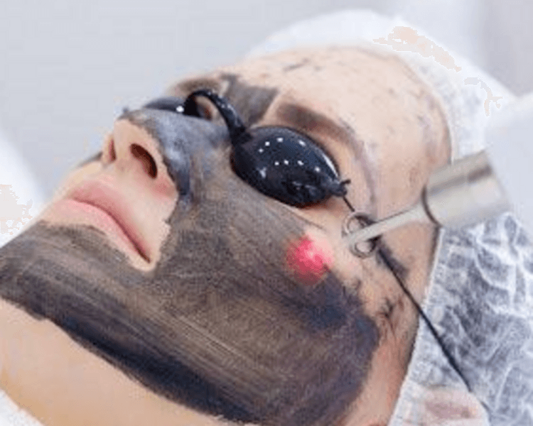 Hollywood Peel