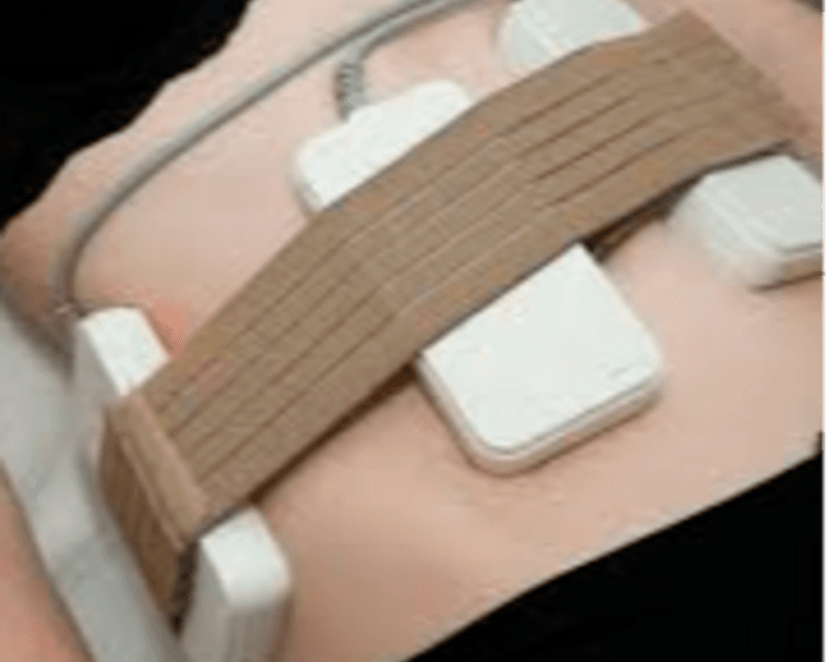 Lipolaser (1 zona, x 6 sesiones de 45 minutos)