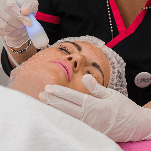 Radio frecuencia 1 zona