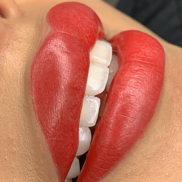 MICROPIGMENTACION DE LABIOS