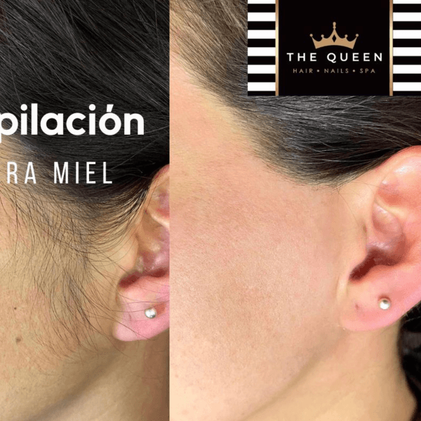 Depilación Patillas