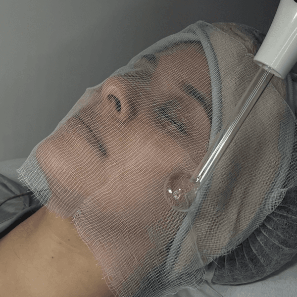 Limpieza Facial