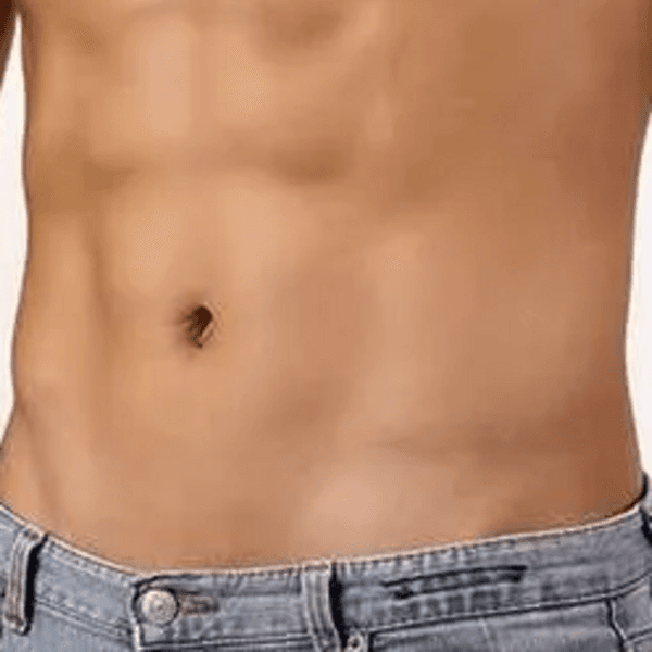 Depilación Abdomen Hombre