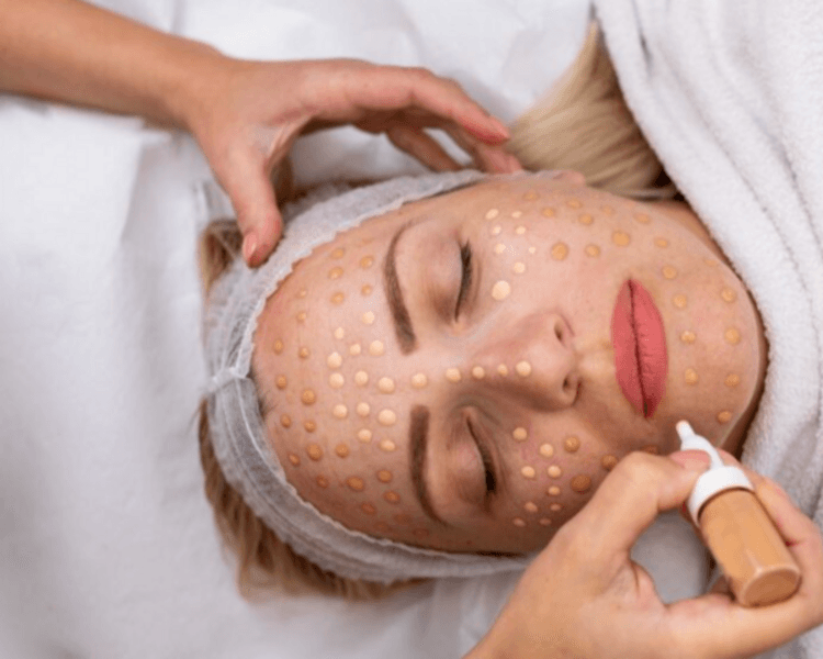 Dermapen BB Glow