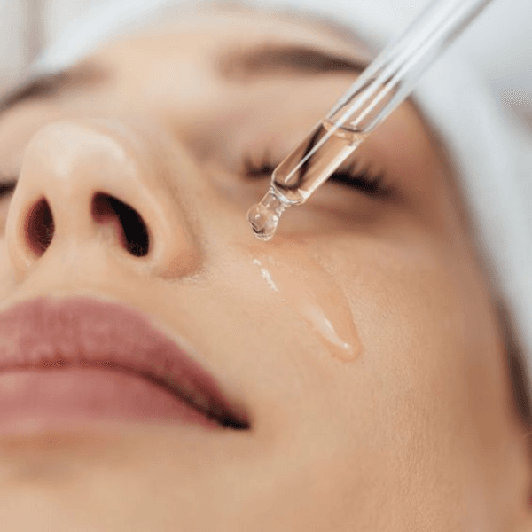 Peeling Quimico (incluye limpieza)