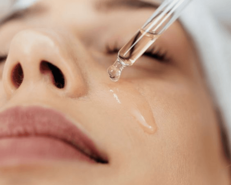 Peeling Quimico (incluye limpieza)