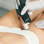 Depilación Láser Motus Ax photo