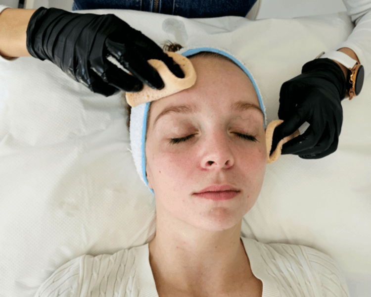 PEELING QUÍMICO DE VERANO HASTA EL 31/3 X 4 SESIONES