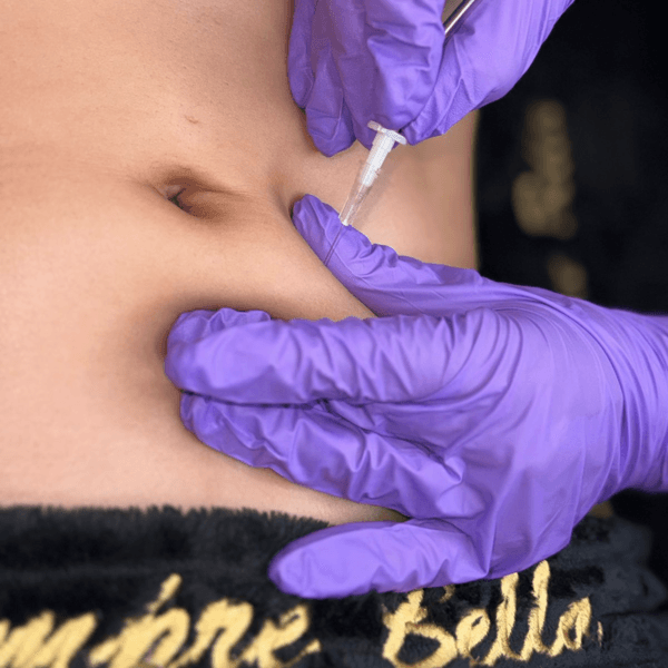 Carboxiterapia Paquete