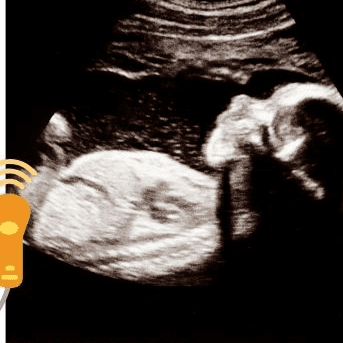Ecografia photo