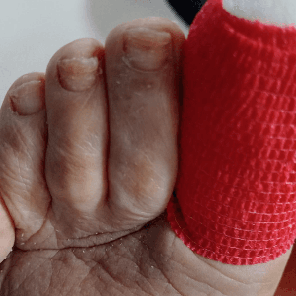 Control de Despiculización