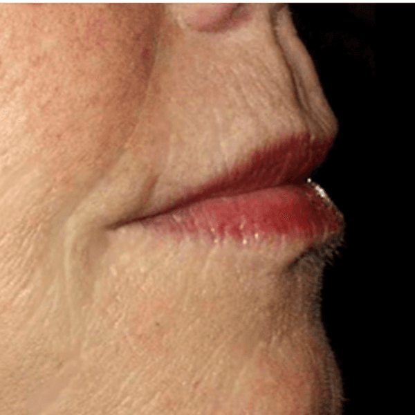 Relleno Código de Barras