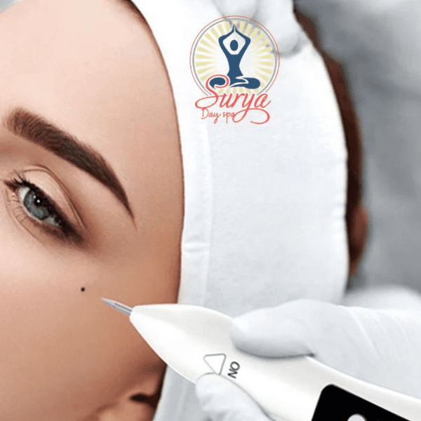 Cauterizador De Verrugas