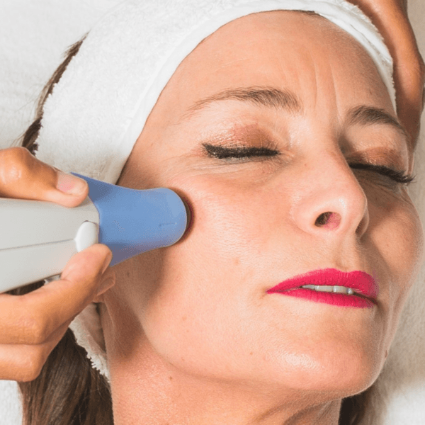 Exilis Rostro Completo