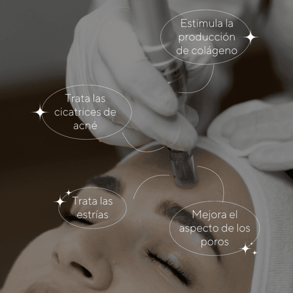 Microneedling 4 sesiones