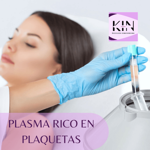 PLASMA RICO EN PLAQUETAS