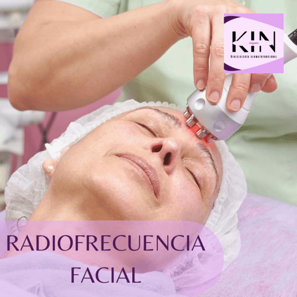 RADIOFRECUECIA FACIAL