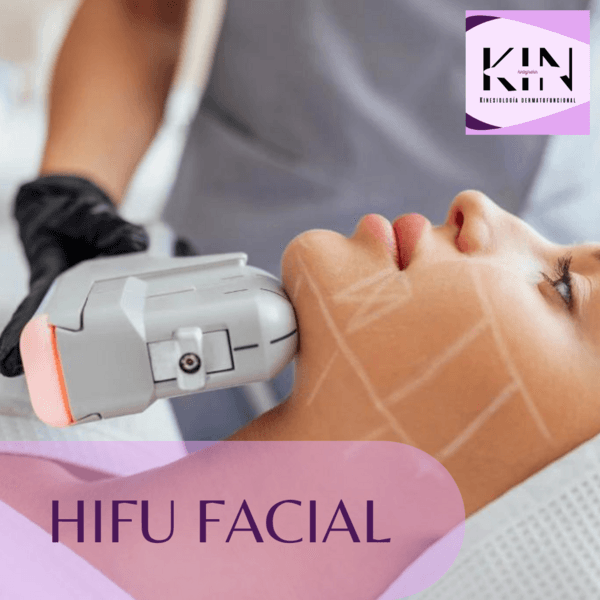 HIFU ROSTRO COMPLETO CON PAPADA
