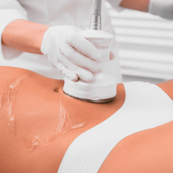 Ultracavitación + Mesoterapia