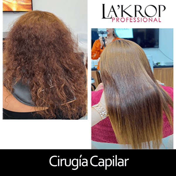 CIRUGIA CAPILAR
