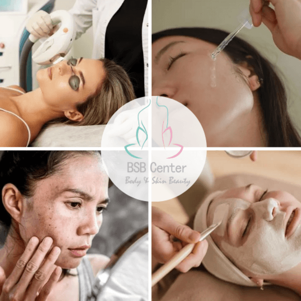 Despigmentante Paquete 3