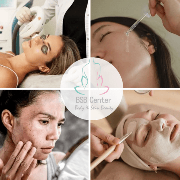 Despigmentante Paquete 6