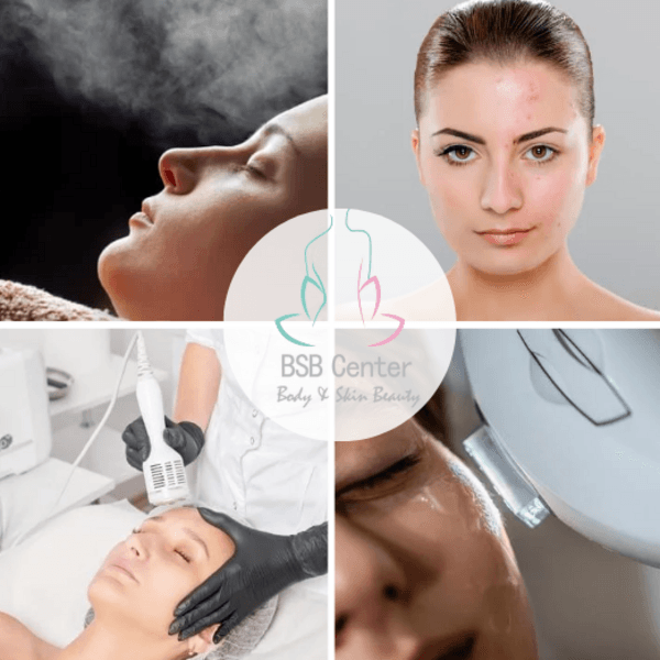 Control Grasa Paquete 3