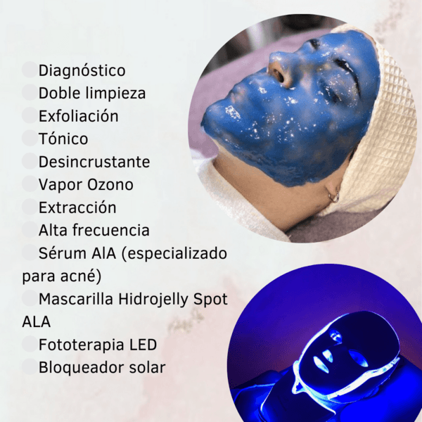 Limpieza Facial Especializada pieles con acné