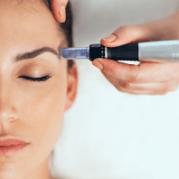 RECOVERY (ACTIVACION DE CRECIMIENTO DE CEJAS)