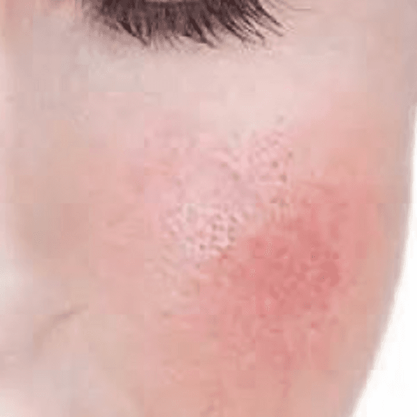 Peeling Argilac Pieles sensibles