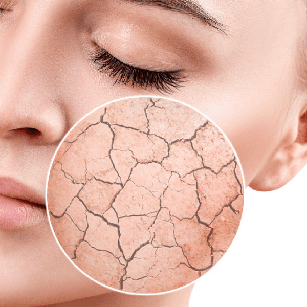 Peeling ferulico Todo tipo de piel