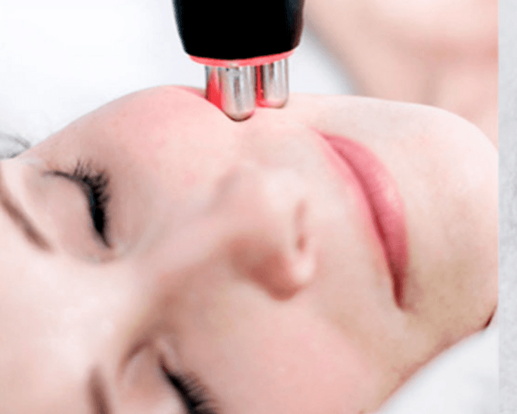 Radiofrecuencia corporal (1 zona, sesión individual)